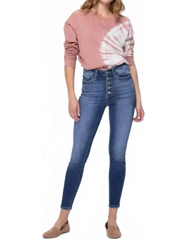 Bailey Highrise Button Fly Skinny Jeans